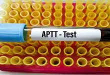 aPTT Testi
